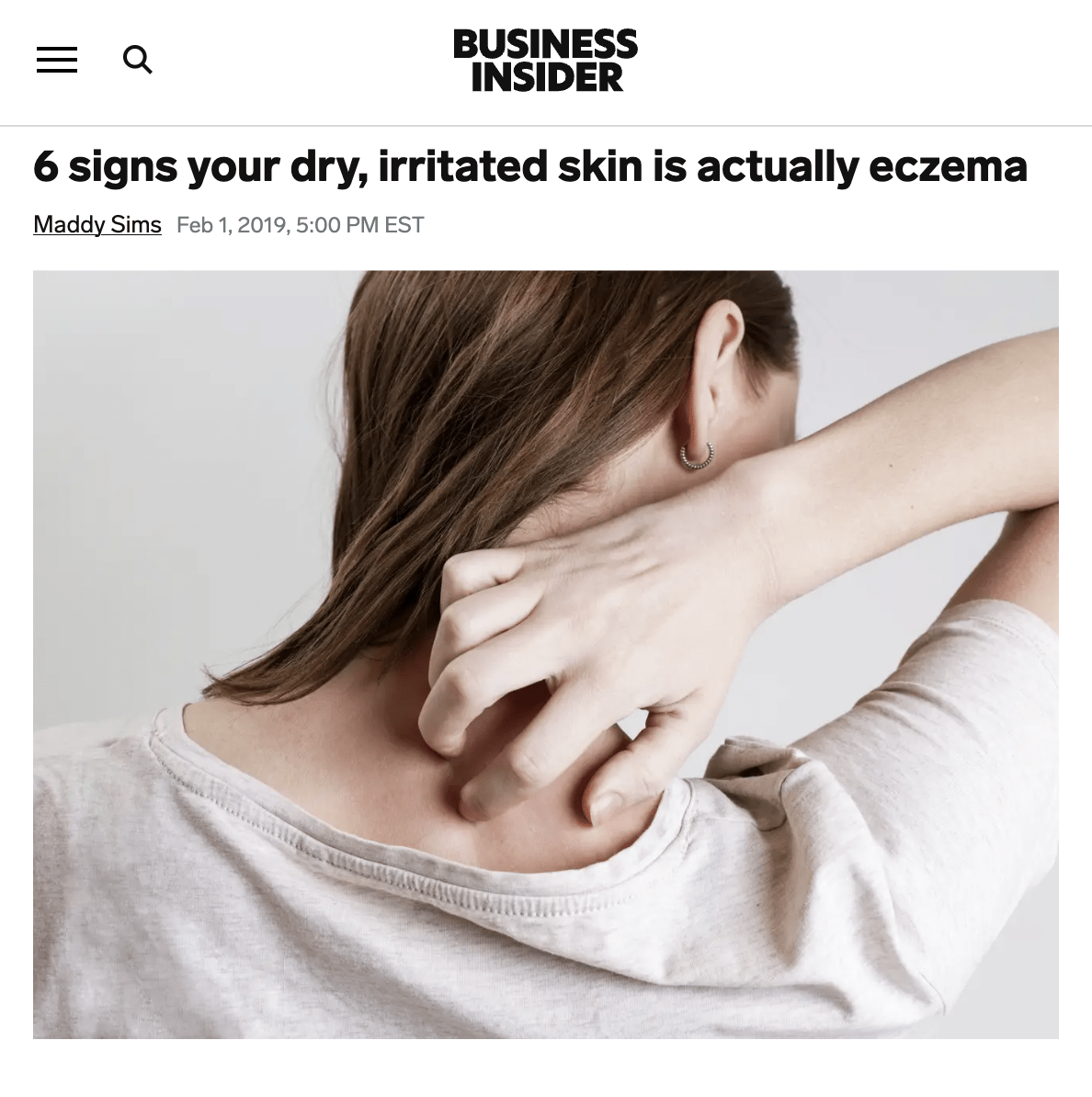 Business Insider - 6 signs your dry, irritated skin is actually eczema